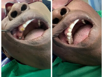 Deans Dental Implants - Runda Mall (Kiambu Road)