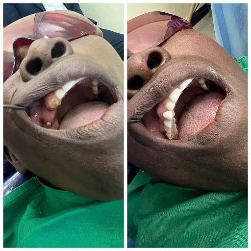 Deans Dental Implants - Runda Mall (Kiambu Road)