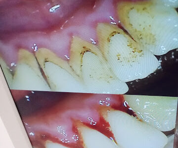 Access Smile Dental Clinic