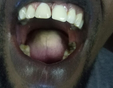 Lemacate Global Dental Clinics-Kaloleni Mobasa