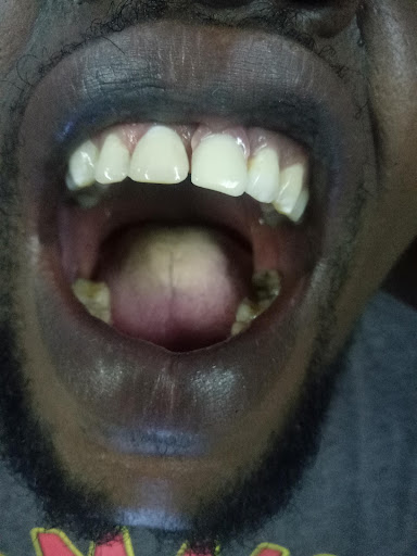 Lemacate Global Dental Clinics-Kaloleni Mobasa