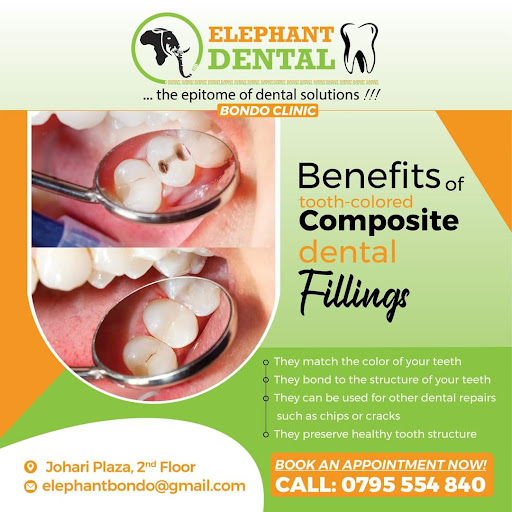 Elephant Dental Bondo