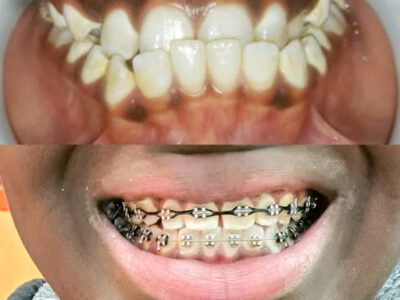 Elephant Dental Rongai Clinic