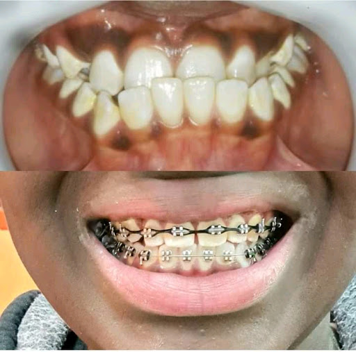 Elephant Dental Rongai Clinic