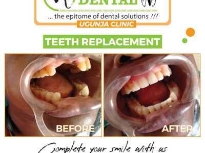 Elephant Dental Clinic Ugunja