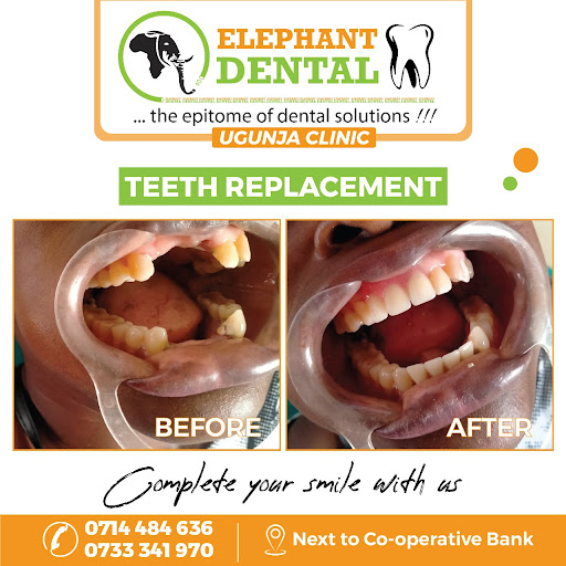 Elephant Dental Clinic Ugunja