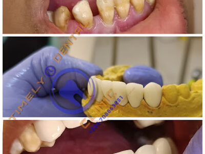 Timely Dental Clinic Mombasa