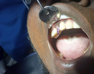 Elephant Dental Nakuru