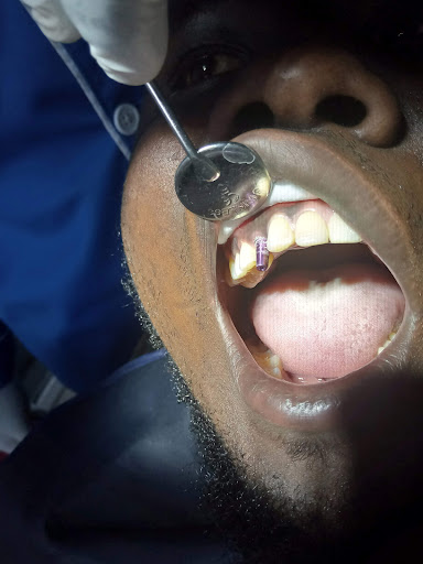 Elephant Dental Nakuru