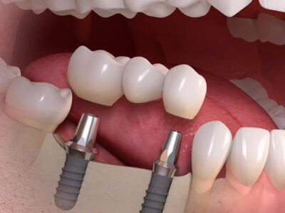 Saffron Khan Dental Center