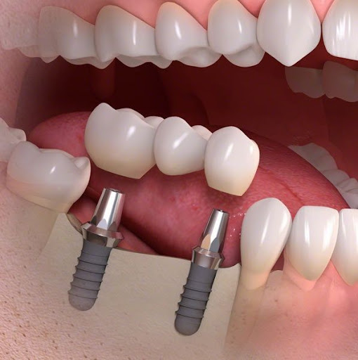 Saffron Khan Dental Center