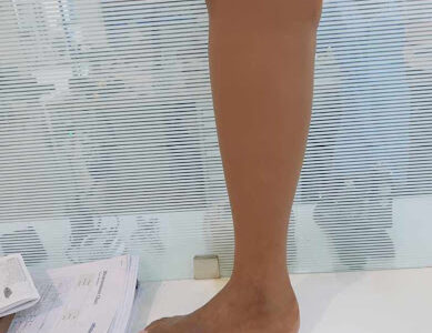 Optima Prosthetics And Orthotics Center.