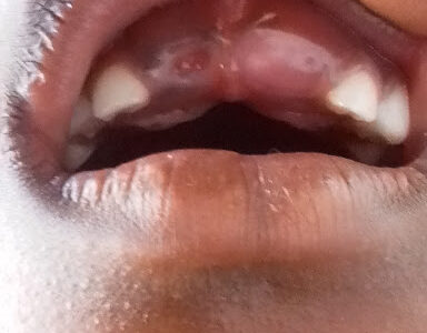 Zeradental Solutions