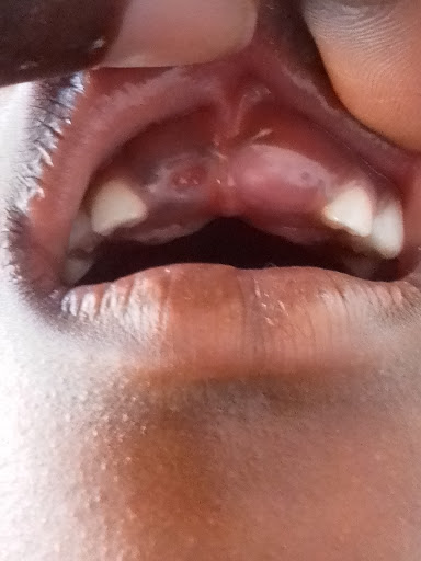 Zeradental Solutions