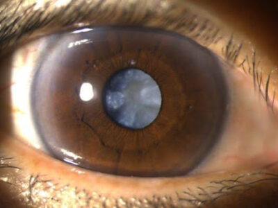 Isiolo Eye Hospital Ltd