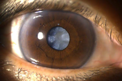 Isiolo Eye Hospital Ltd